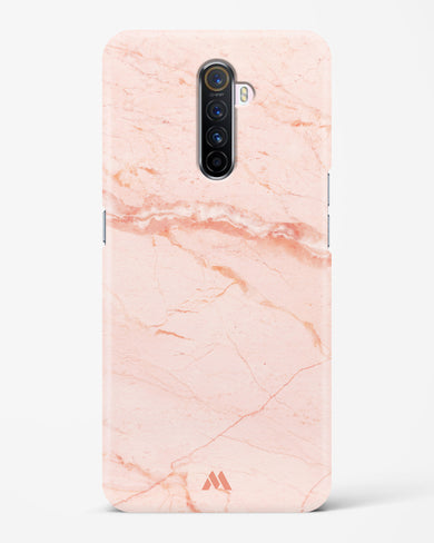 Rose Quartz on Marble Hard Case Phone Cover (Realme)