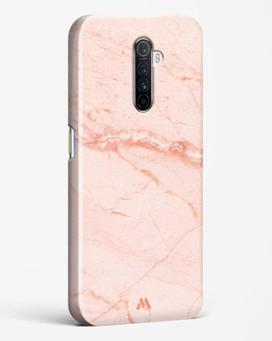 Rose Quartz on Marble Hard Case Phone Cover (Realme)