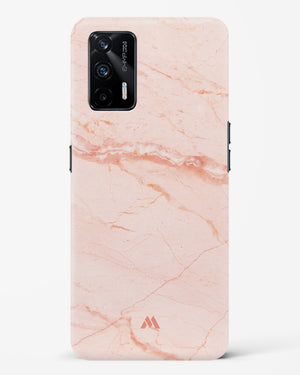 Rose Quartz on Marble Hard Case Phone Cover (Realme)