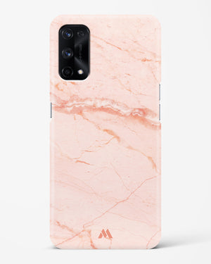 Rose Quartz on Marble Hard Case Phone Cover (Realme)