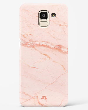 Rose Quartz on Marble Hard Case Phone Cover (Samsung)