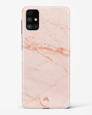 Rose Quartz on Marble Hard Case Phone Cover (Samsung)