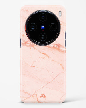 Rose Quartz on Marble Hard Case Phone Cover (Vivo)
