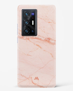 Rose Quartz on Marble Hard Case Phone Cover (Vivo)