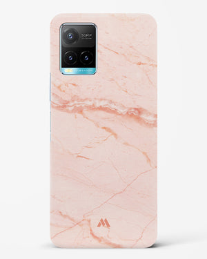 Rose Quartz on Marble Hard Case Phone Cover (Vivo)