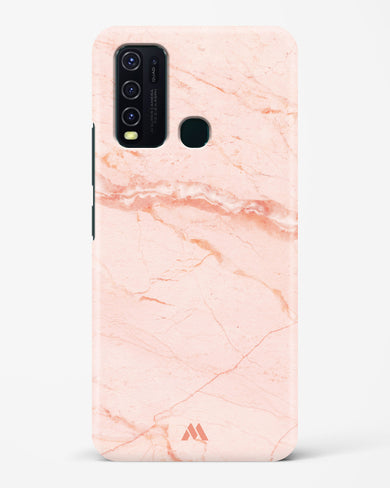 Rose Quartz on Marble Hard Case Phone Cover (Vivo)