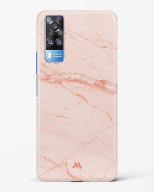 Rose Quartz on Marble Hard Case Phone Cover (Vivo)