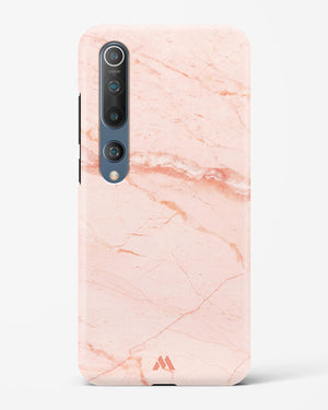 Rose Quartz on Marble Hard Case Phone Cover-(Xiaomi)