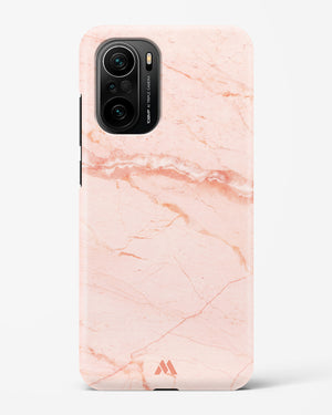 Rose Quartz on Marble Hard Case Phone Cover (Xiaomi)