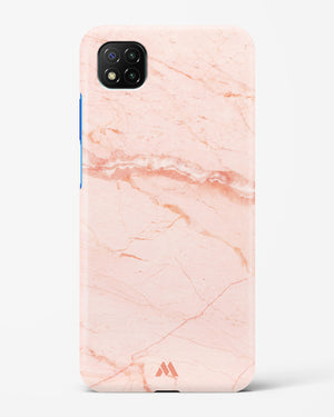Rose Quartz on Marble Hard Case Phone Cover (Xiaomi)