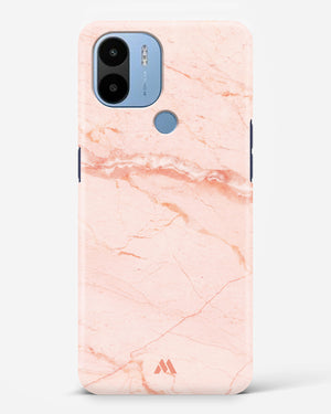 Rose Quartz on Marble Hard Case Phone Cover (Xiaomi)