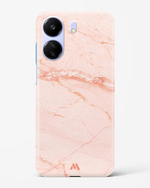 Rose Quartz on Marble Hard Case Phone Cover (Xiaomi)