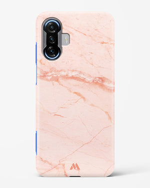 Rose Quartz on Marble Hard Case Phone Cover (Xiaomi)
