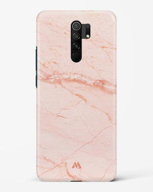 Rose Quartz on Marble Hard Case Phone Cover (Xiaomi)