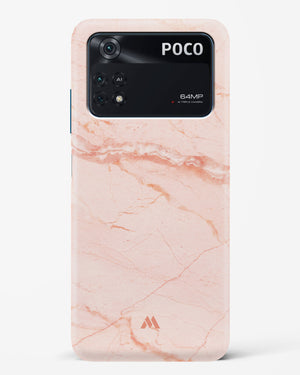 Rose Quartz on Marble Hard Case Phone Cover (Xiaomi)