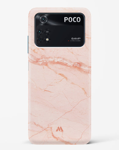 Rose Quartz on Marble Hard Case Phone Cover (Xiaomi)