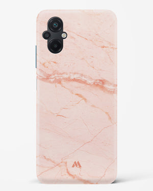 Rose Quartz on Marble Hard Case Phone Cover (Xiaomi)
