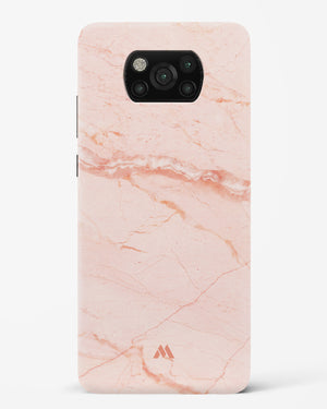 Rose Quartz on Marble Hard Case Phone Cover (Xiaomi)