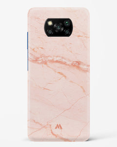 Rose Quartz on Marble Hard Case Phone Cover (Xiaomi)