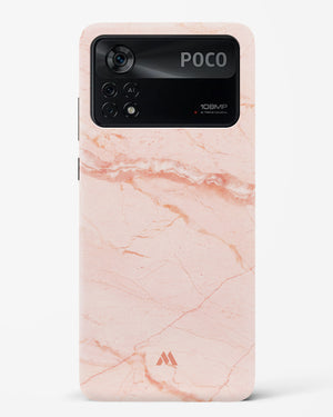 Rose Quartz on Marble Hard Case Phone Cover (Xiaomi)