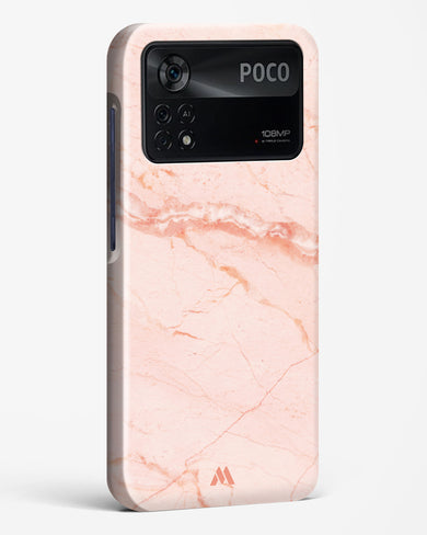 Rose Quartz on Marble Hard Case Phone Cover (Xiaomi)