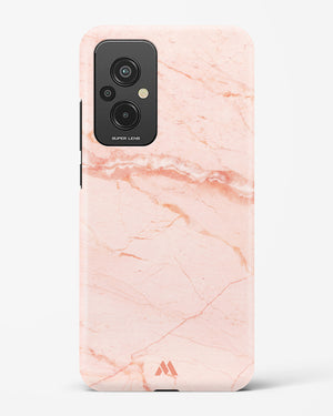 Rose Quartz on Marble Hard Case Phone Cover (Xiaomi)