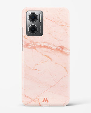 Rose Quartz on Marble Hard Case Phone Cover (Xiaomi)