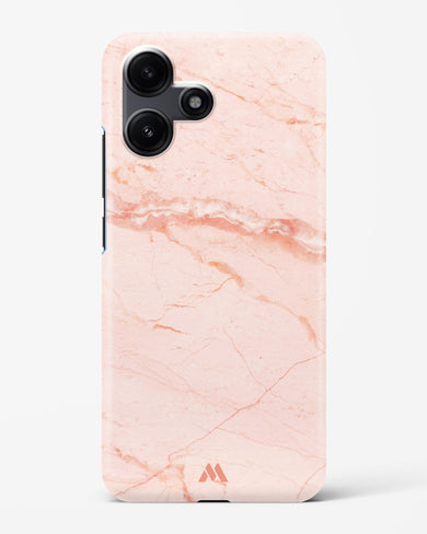 Rose Quartz on Marble Hard Case Phone Cover (Xiaomi)