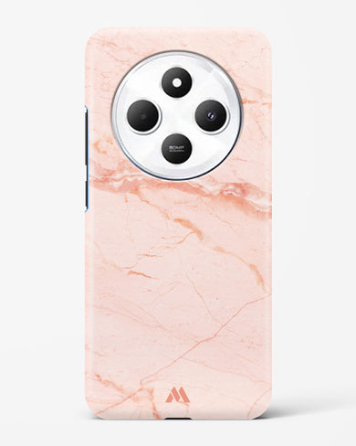 Rose Quartz on Marble Hard Case Phone Cover (Xiaomi)