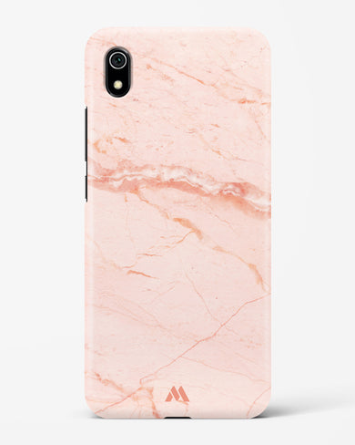Rose Quartz on Marble Hard Case Phone Cover (Xiaomi)