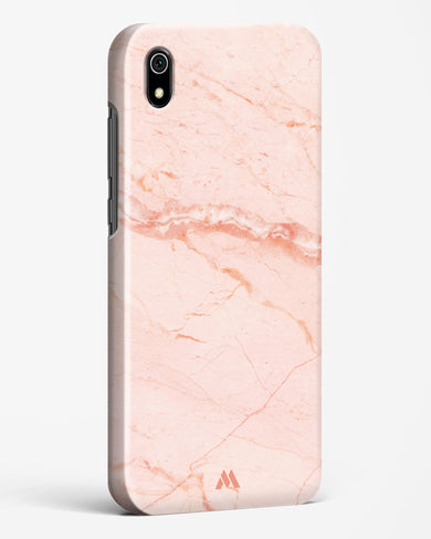 Rose Quartz on Marble Hard Case Phone Cover (Xiaomi)
