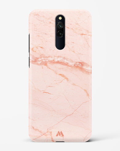 Rose Quartz on Marble Hard Case Phone Cover (Xiaomi)