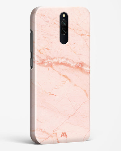 Rose Quartz on Marble Hard Case Phone Cover (Xiaomi)