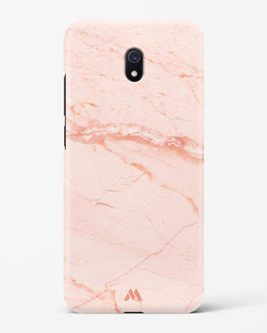 Rose Quartz on Marble Hard Case Phone Cover (Xiaomi)