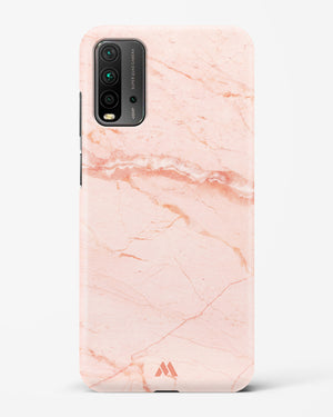Rose Quartz on Marble Hard Case Phone Cover (Xiaomi)