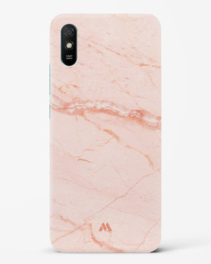 Rose Quartz on Marble Hard Case Phone Cover (Xiaomi)