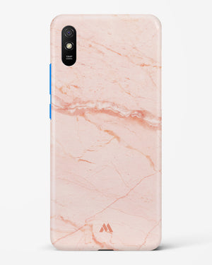 Rose Quartz on Marble Hard Case Phone Cover (Xiaomi)