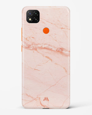 Rose Quartz on Marble Hard Case Phone Cover (Xiaomi)