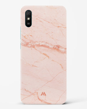 Rose Quartz on Marble Hard Case Phone Cover-(Xiaomi)