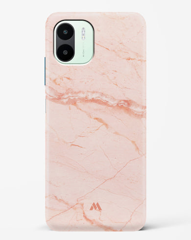 Rose Quartz on Marble Hard Case Phone Cover (Xiaomi)