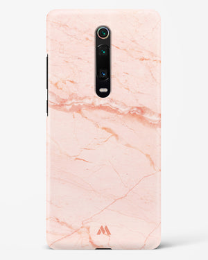 Rose Quartz on Marble Hard Case Phone Cover (Xiaomi)
