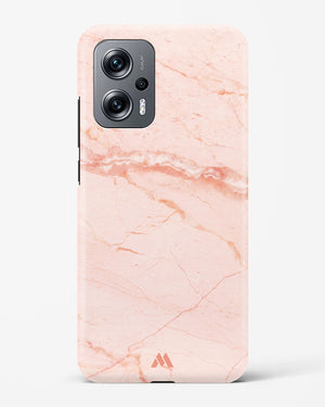 Rose Quartz on Marble Hard Case Phone Cover (Xiaomi)