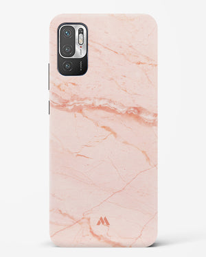 Rose Quartz on Marble Hard Case Phone Cover (Xiaomi)