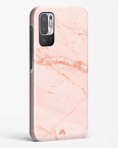 Rose Quartz on Marble Hard Case Phone Cover (Xiaomi)