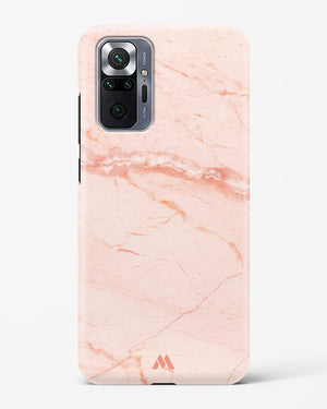 Rose Quartz on Marble Hard Case Phone Cover (Xiaomi)