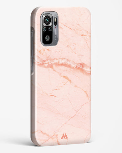 Rose Quartz on Marble Hard Case Phone Cover (Xiaomi)