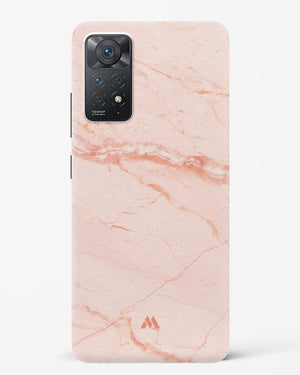 Rose Quartz on Marble Hard Case Phone Cover (Xiaomi)