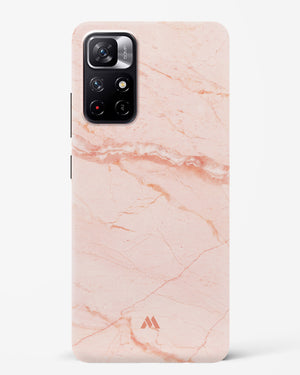 Rose Quartz on Marble Hard Case Phone Cover (Xiaomi)