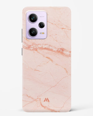 Rose Quartz on Marble Hard Case Phone Cover (Xiaomi)
