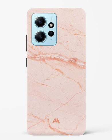 Rose Quartz on Marble Hard Case Phone Cover (Xiaomi)